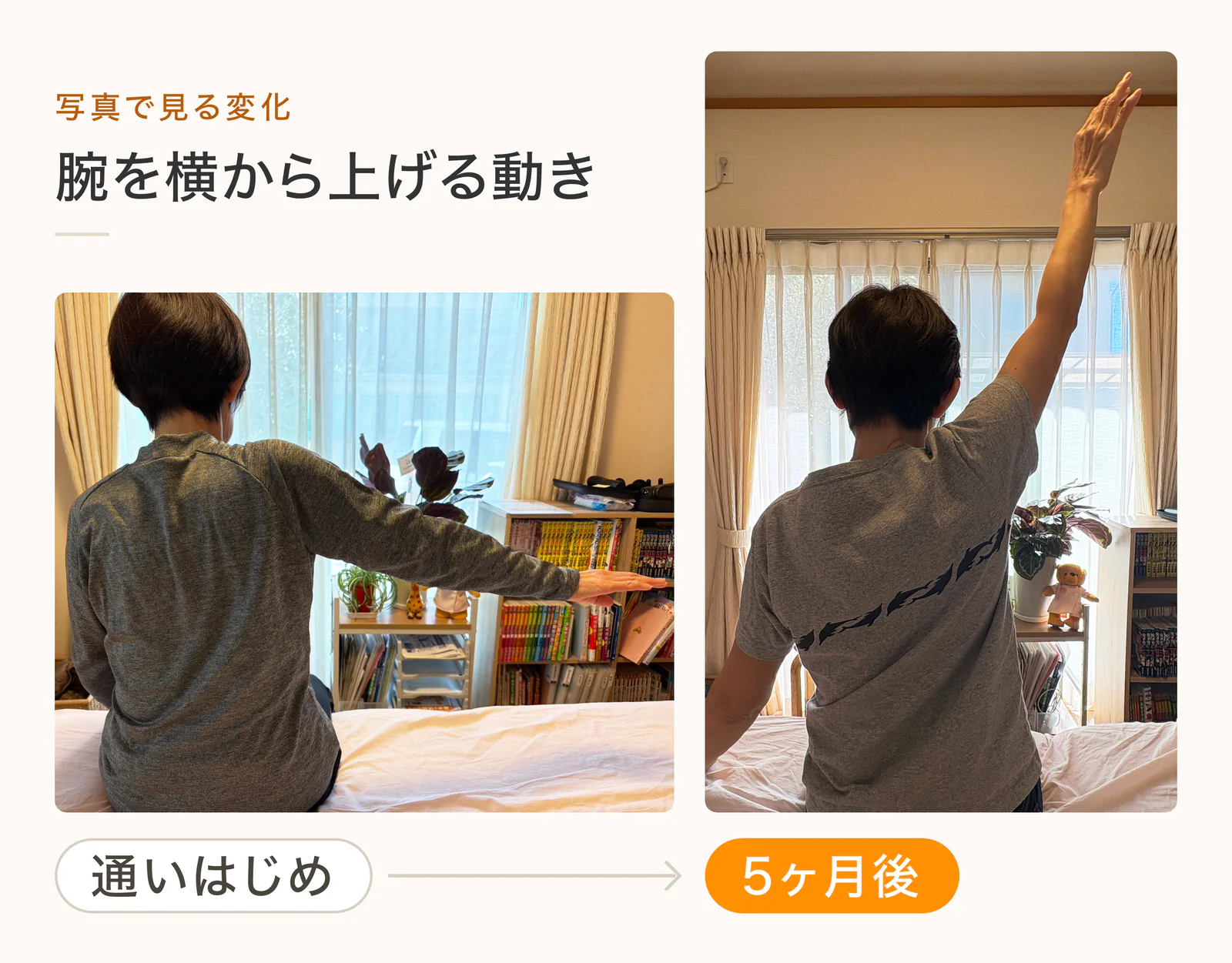 腕を横から上げる動きの比較写真。通いはじめは肩の高さより少し下までだった腕が、5ヶ月後は頭より高く上がっている